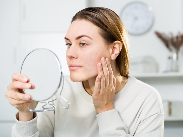 Niacinamide vs Hyaluronic Acid for Dry Skin: Which Is Better?