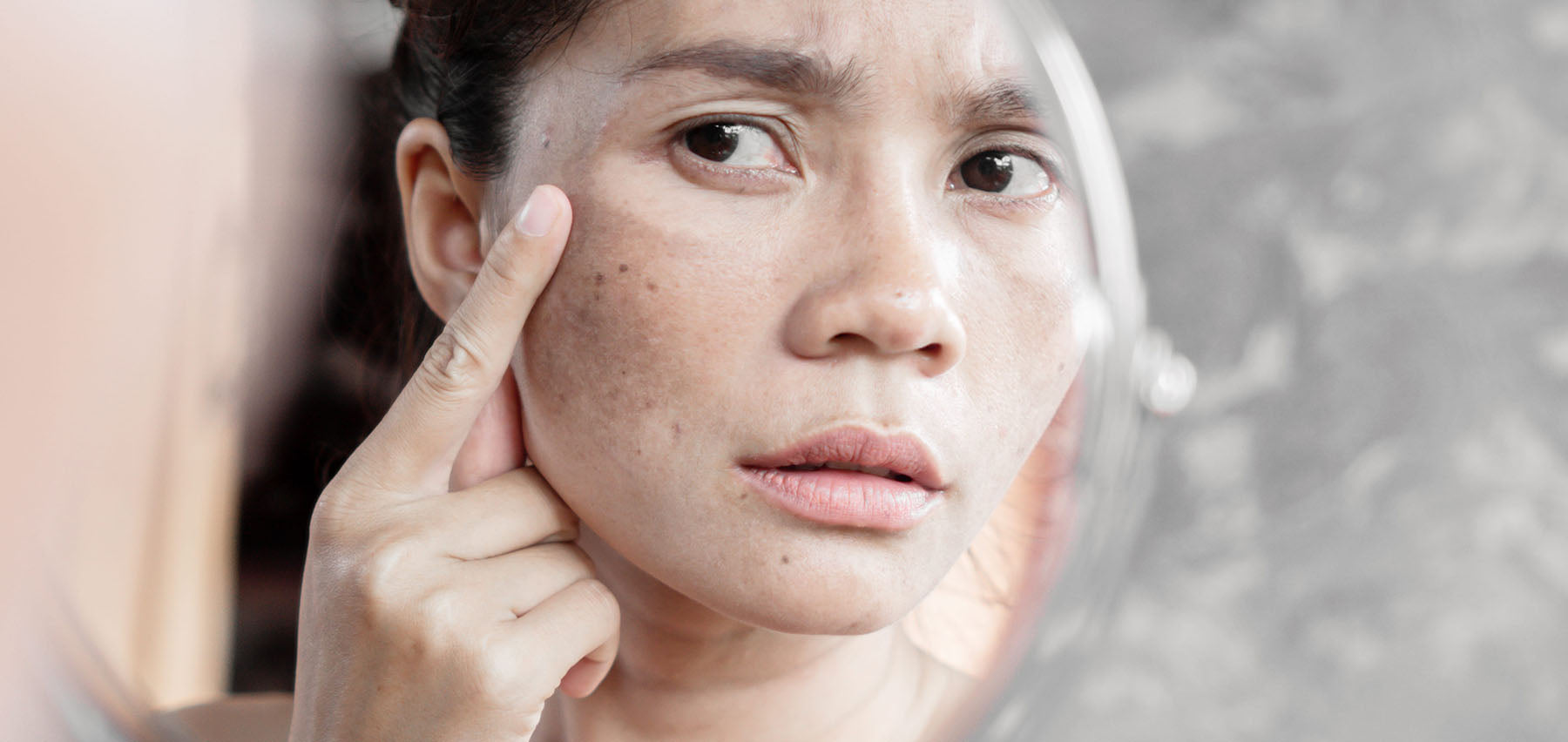 Niacinamide vs Vitamin C: Which Is Better for Reducing Dark Spots & Hyperpigmentation?