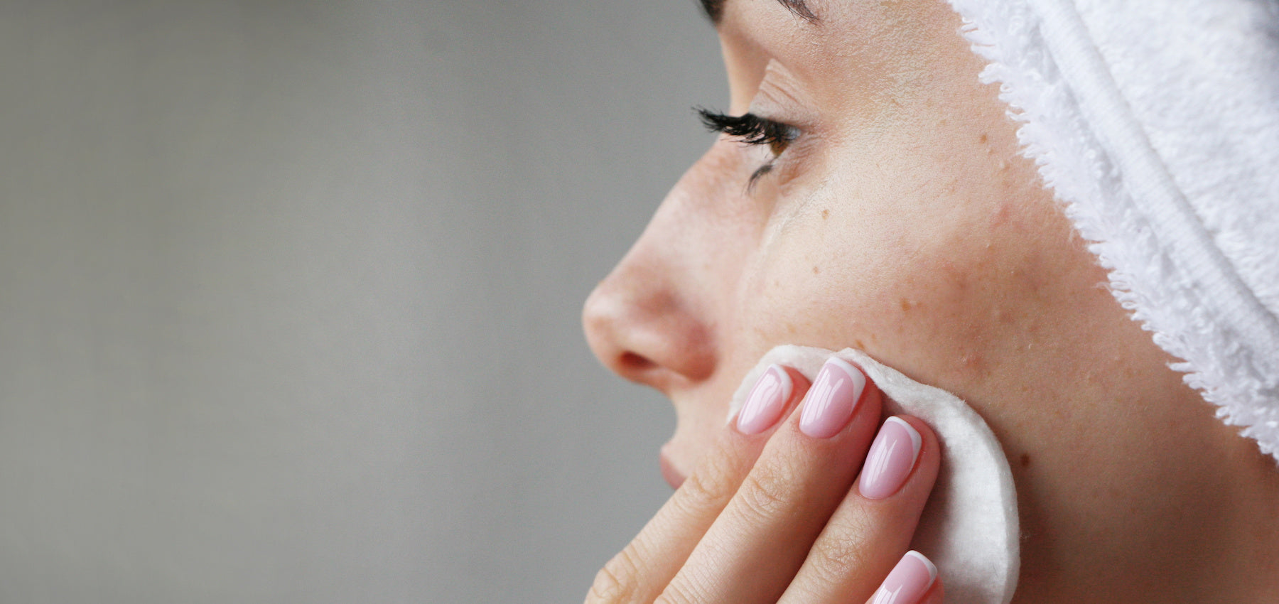 5 Common Skincare Issues and How to Avoid Them