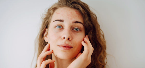 How To Use Coenzyme Q10 Serum for Facial Redness | Small Batch Serums