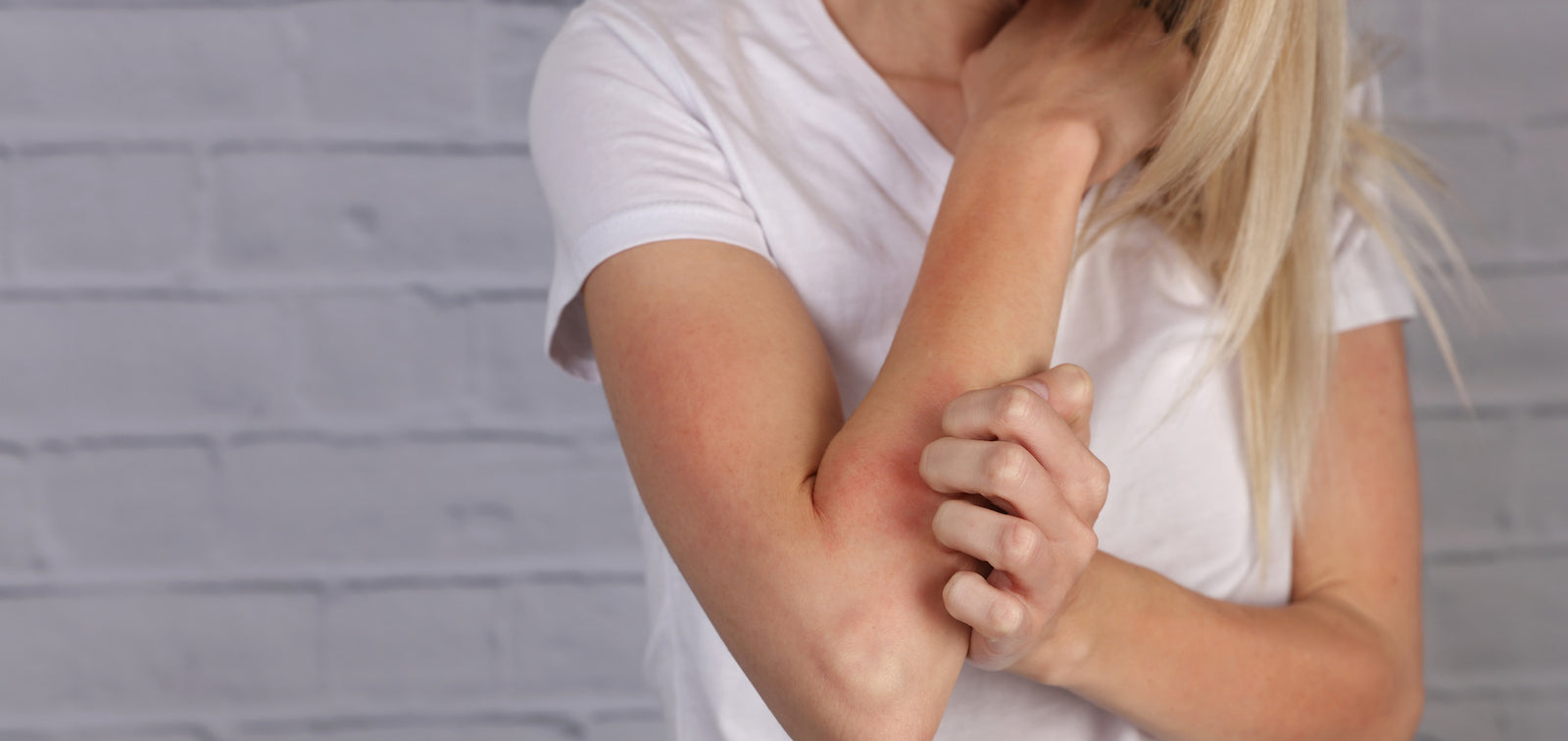 Coenzyme Q10 for Eczema: How It Can Help & How To Use It