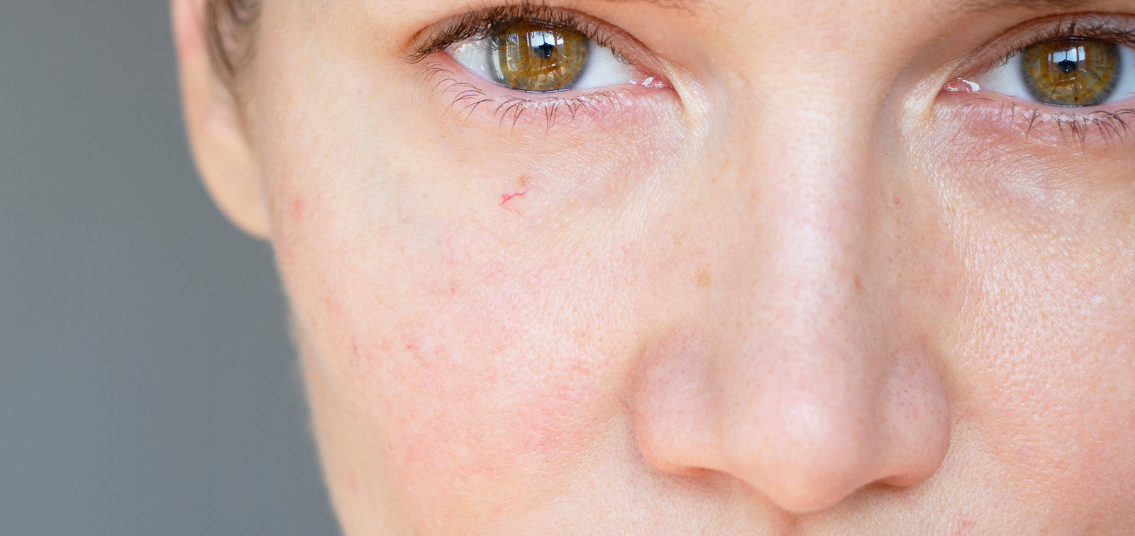 How To Tell If Your Skin Barrier Is Damaged