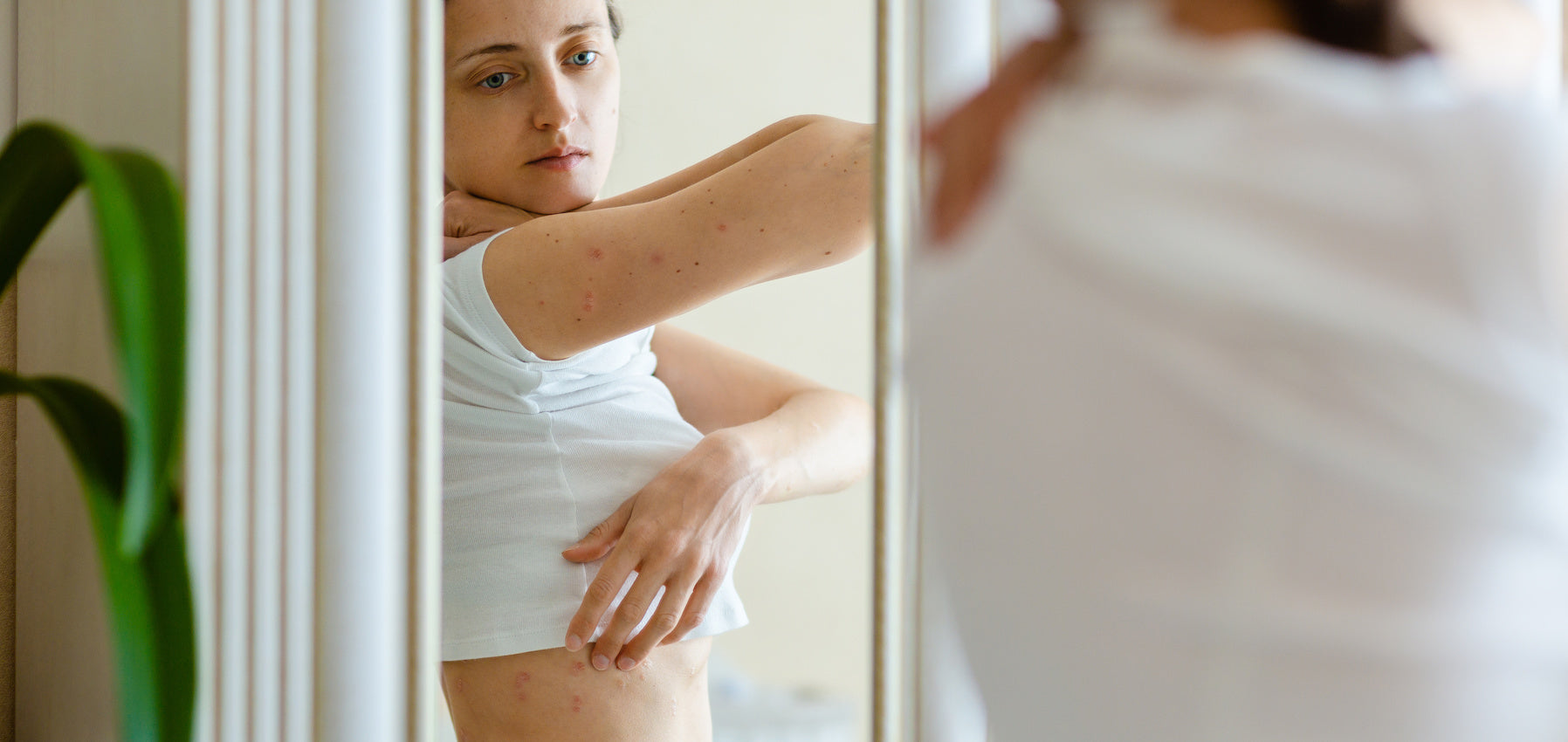 Eczema vs Psoriasis: Main Differences and Best Products to Treat Them