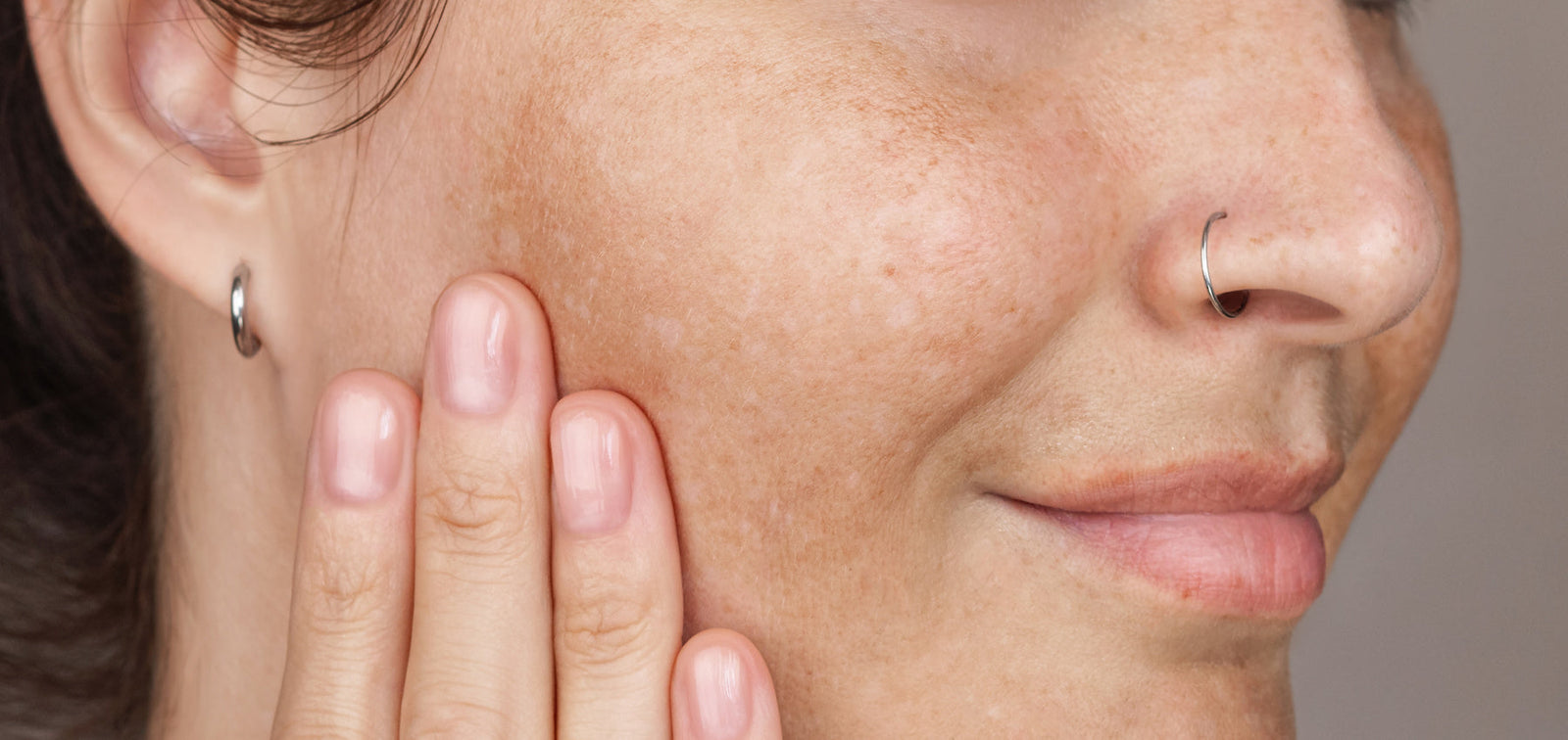 Your Guide to Vitamin C For Dark Spots & Hyperpigmentation