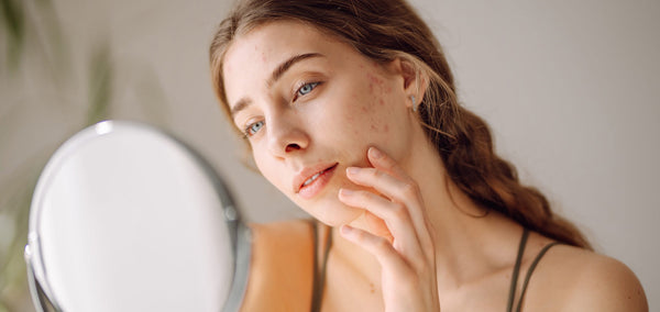 7 Signs Your Skin Barrier is Damaged & How To Fix It